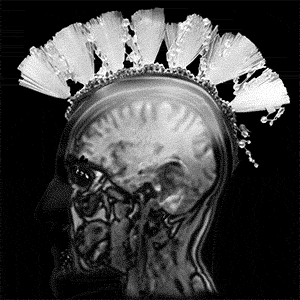 brain mri superimposed over a profile with a white fake mohawk
